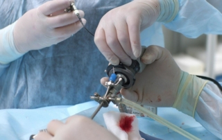 endoscopie